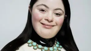 Ellie Goldstein: Redefining Beauty in the Fashion Industry