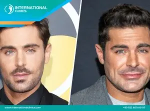 Zac Efron: From Disney Star to Versatile Actor