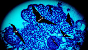 Nipah Virus Outbreak in India: Latest Developments and Implications