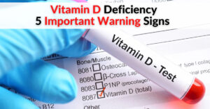 Understanding the Recent Vitamin D Warning: Implications for Your Health