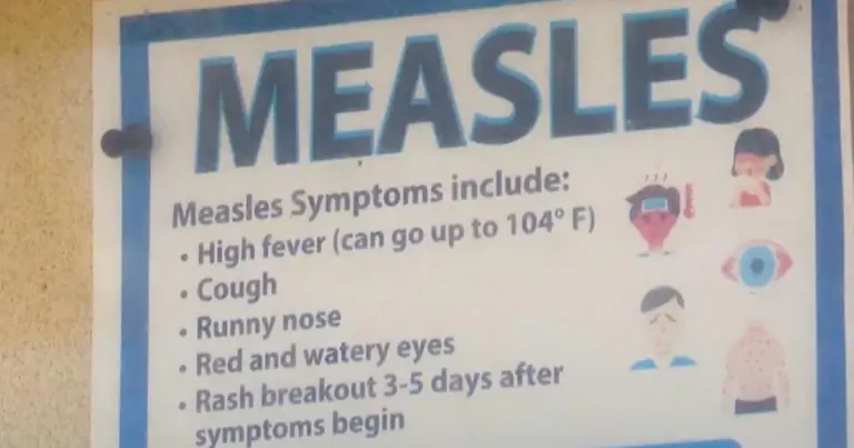 Identifying Measles Symptoms: What You Need to Know
