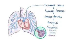 What You Need to Know About Pulmonary Embolism