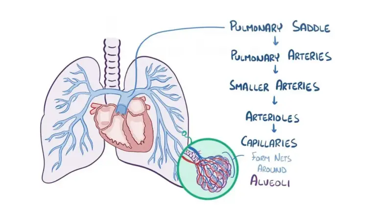 What You Need to Know About Pulmonary Embolism