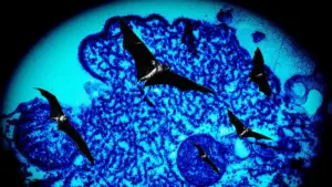 nipah virus — IN news